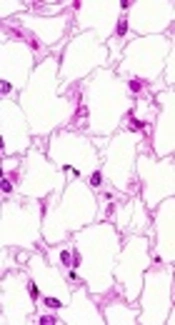 Adipose Tissue Derived- Stem Cells: Applications and Benefits in Tissue Regeneration